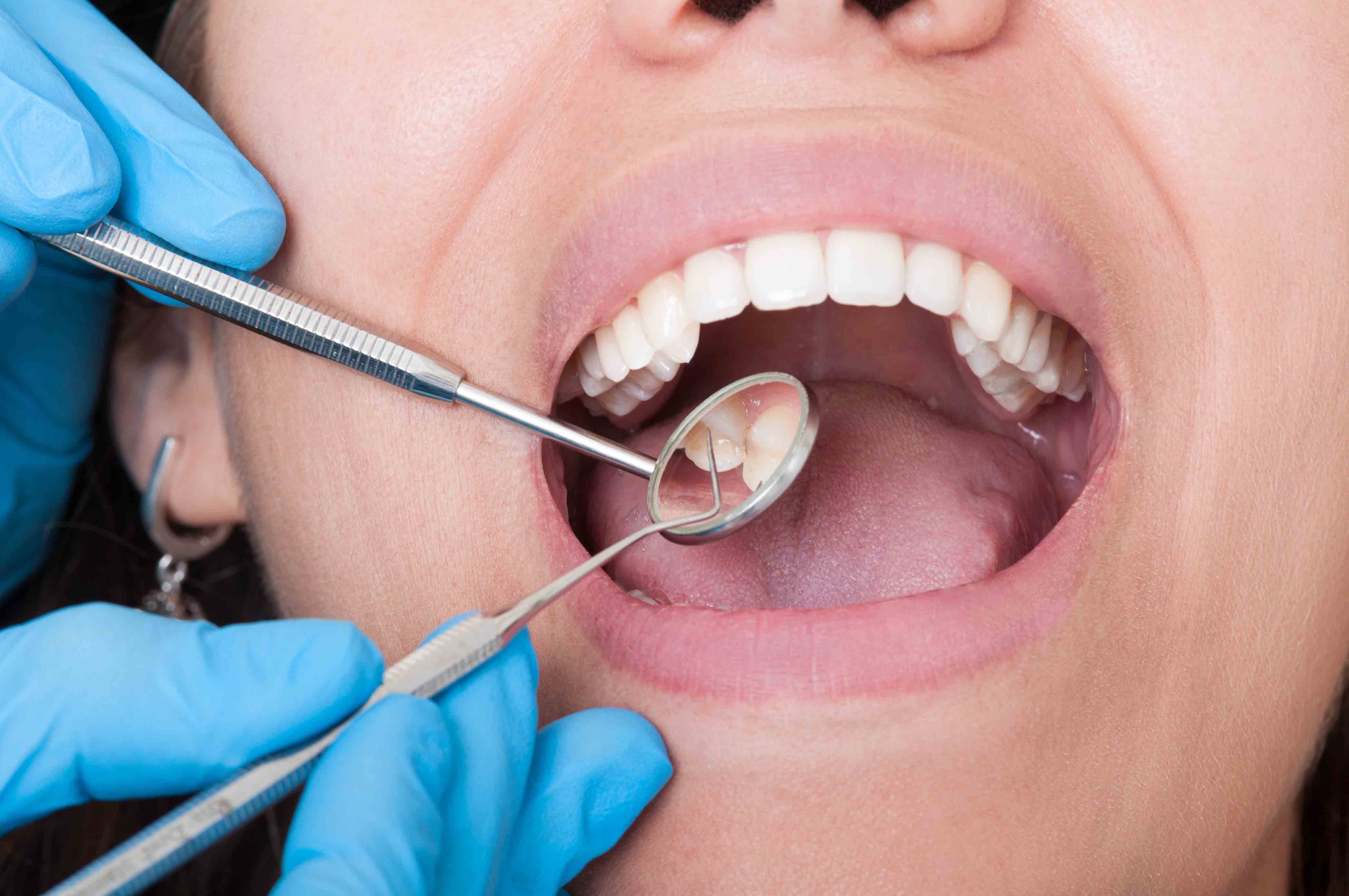 Oral Hygiene - North Coast Dentist | Fresh Dental Care